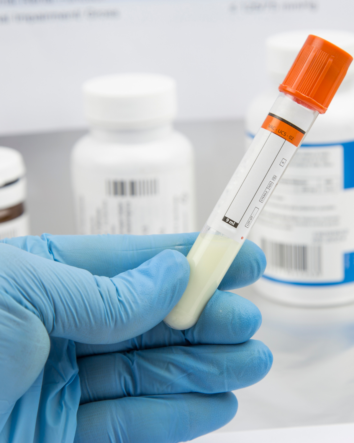 Semen testing as part of a fertility assessment